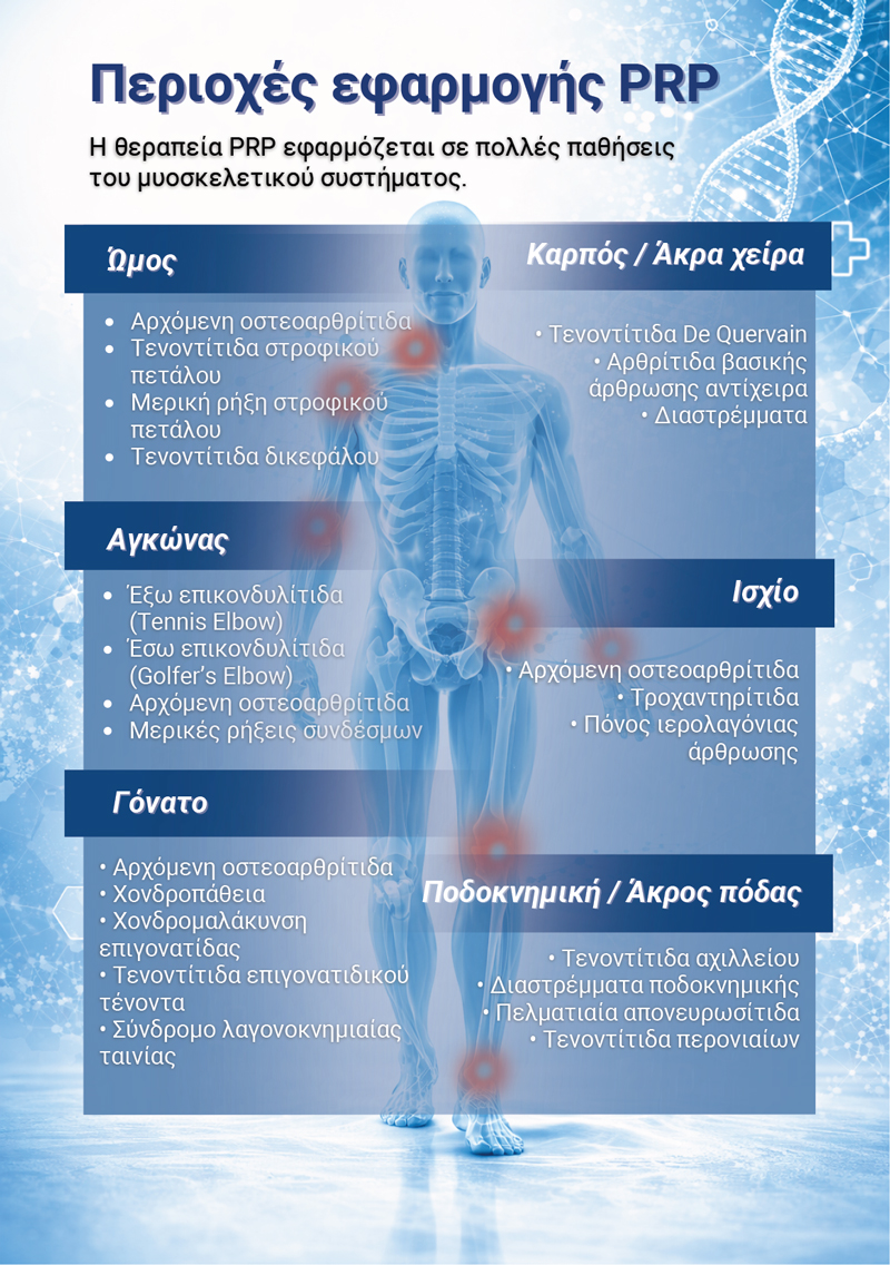psp med prp therapy periohes efarmogis